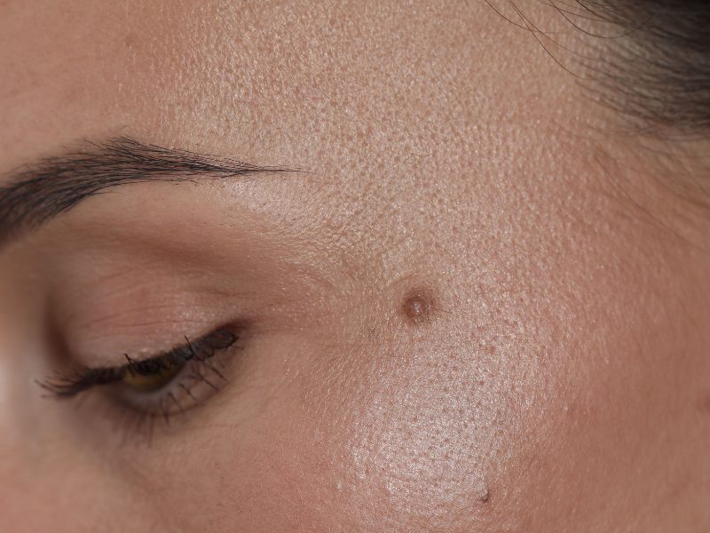 plastische aesthetische chirurgie berlin hautveraenderungen dr gregory