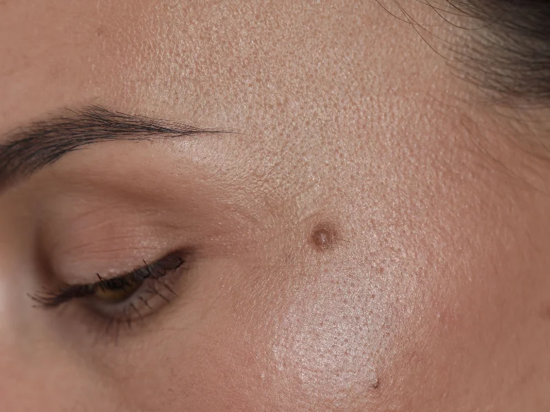 plastische aesthetische chirurgie berlin hautveraenderungen dr gregory